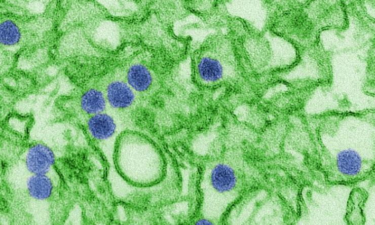 A digitally-colorized transmission electron micrograph (TEM) of Zika virus. Virus particles (colored in blue), are 40 nm in diameter, with an outer envelope, and an inner dense core.